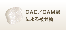 CAD／CAM冠による被せ物