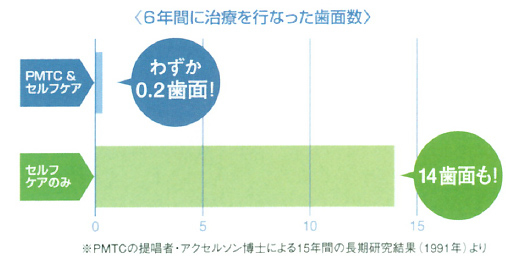 虫歯の予防効果が70倍に！