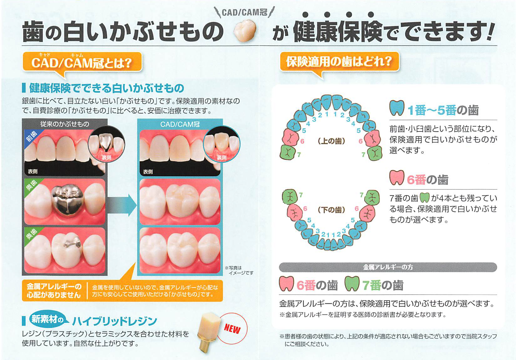 CAD／CAＭ冠・CAD／CAＭインレーの保険導入について