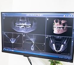 ドイツ製低被ばくCT