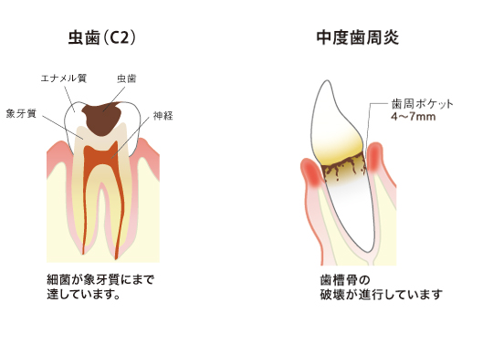 一般歯科治療