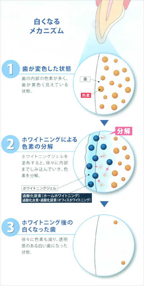 白くなるメカニズム